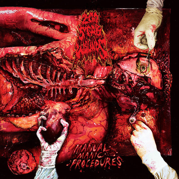 200 STAB WOUNDS - Manual Manic Procedures LP (DARK LIVER MARBLE) (Preorder)